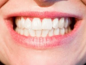 Your Genetic History and Your Oral Health