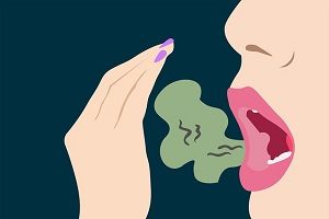 What Causes Bad Breath?