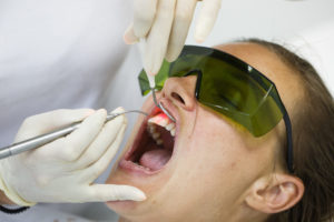 Benefits of Deep Cleaning Dental Treatments annapolis dental care