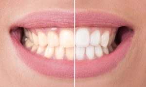 Annapolis Dental Care cosmetic dentist in Bay Ridge Junction