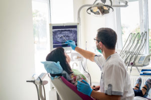 annapolis dental care dental bonding removed