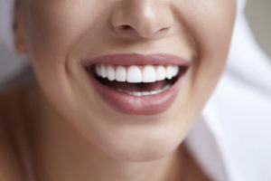 annapolis-dental-care-teeth-whitening-veneers