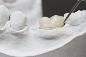 annapolis dental care Guarantee Tooth Extraction