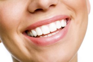 Annapolis Dental Care Veneers Dentist in Truxton Heights