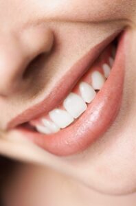 annapolis dental care cosmetic dentistry