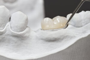 annapolis dental care teeth replacement