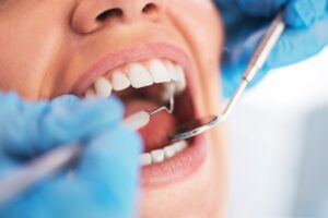 annapolis dental care oral health this summer