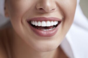 annapolis dental care dental veneers