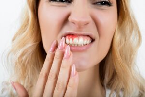 annapolis dental care gum disease