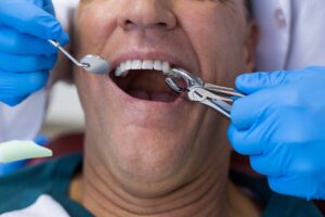 annapolis dental care prevent tooth decay annapolis dental care prevent tooth decay